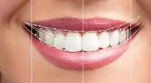Smile Designing in Kadapa Smile Designing in Kadapa