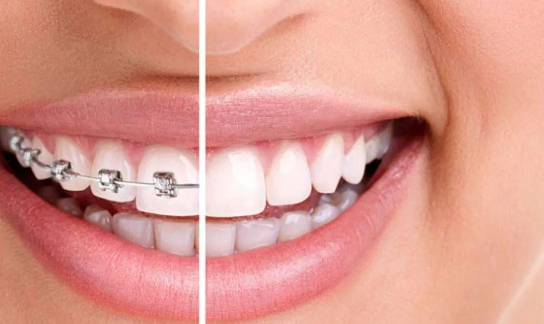 Top 10 Myths About Dental Care—Busted!